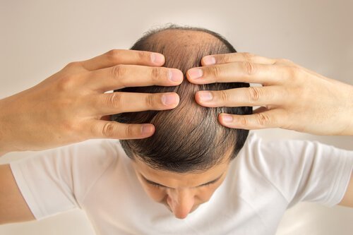 Conheça a razão da queda do seu cabelo
