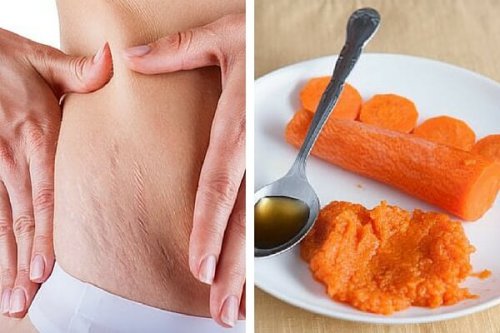 A cenoura ajuda a diminuir estrias na pele