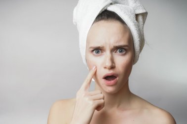 Dieta para controlar a acne: que alimentos devo evitar?