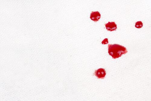 Manchas de sangue na roupa branca: como tirá-las