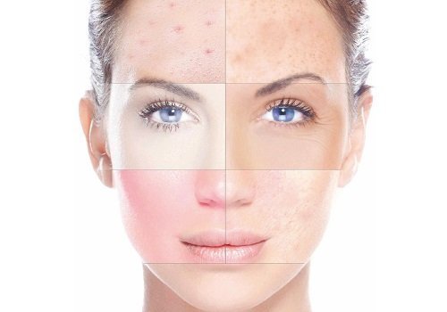 Leve em consideração o seu tipo de pele ao escolher uma máscara de cílios