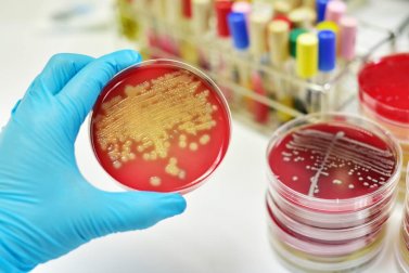 Combata os sintomas da septicemia com estas plantas medicinais