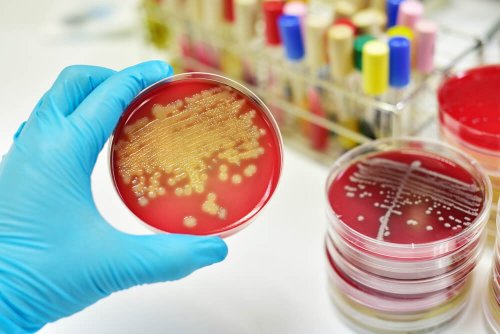 Combata os sintomas da septicemia com estas plantas medicinais