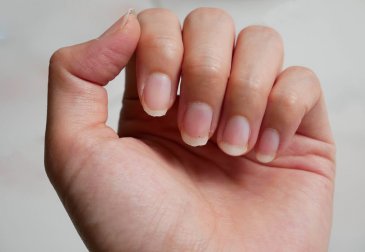 Unhas quebradiças: remédios que você precisa conhecer
