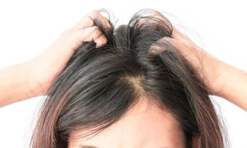 5 remédios naturais para aliviar a coceira no couro cabeludo