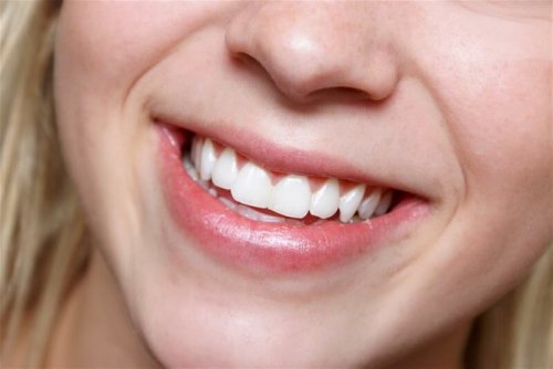 Mulher sorrindo: saúde bucal