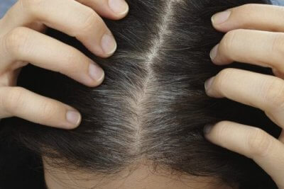 Fios brancos prematuros: dicas para preveni-los