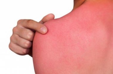 O que a pele precisa após terminar o verão?