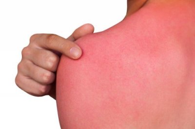 O que a pele precisa após terminar o verão?