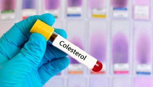 Tratamento do colesterol com plantas medicinais