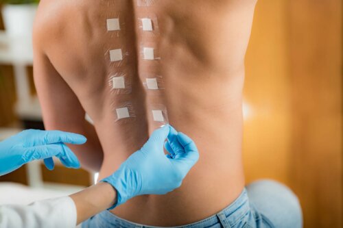 Como se realiza o patch test ou testes epicutâneos?