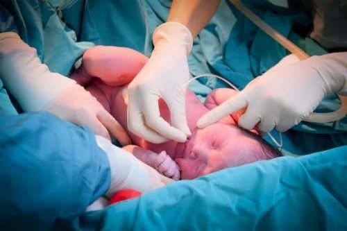 Bebê recém nascido com risco de asfixia perinatal