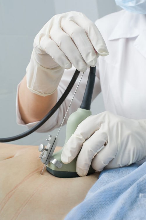 M~edico controlando gravidez molar