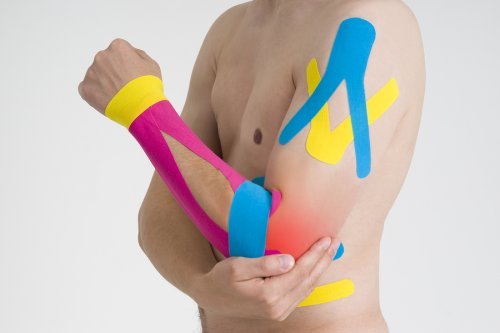 Bandagem neuromuscular nas estremidades superiores