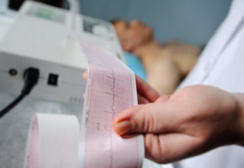 Médico lendo eletrocardiograma