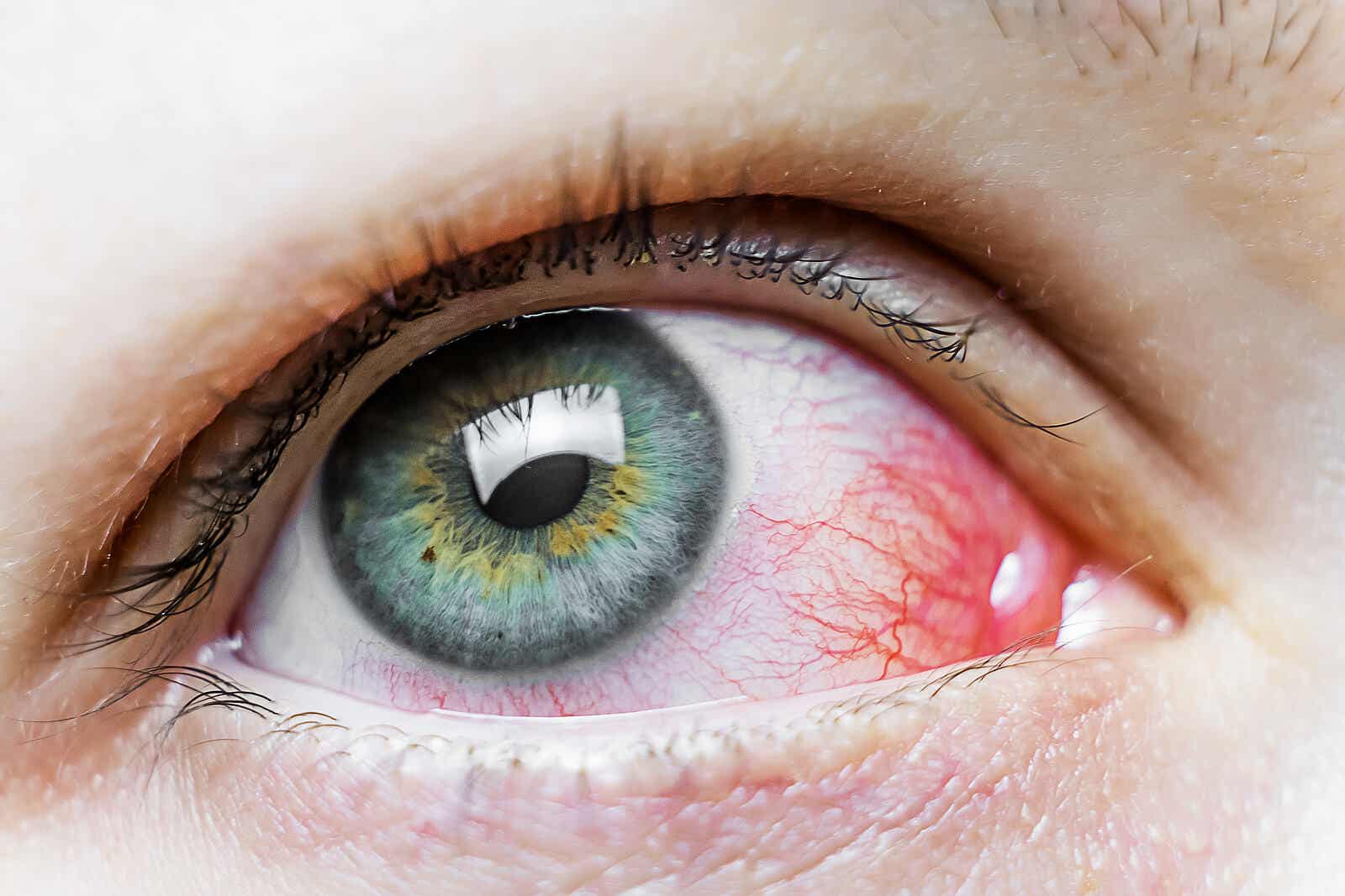 Você sabe o que é a degeneração macular relacionada à idade?