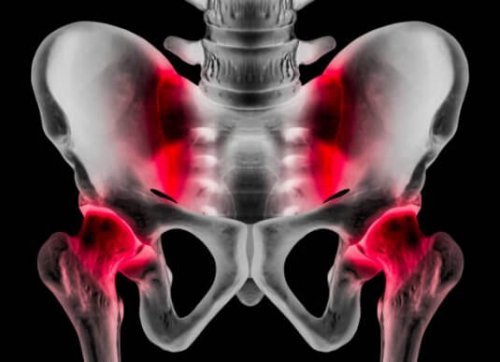 Pubalgia: causas, sintomas e tratamento - Melhor com Saúde