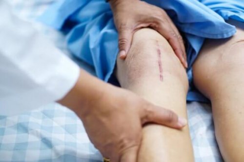 Transplante de cartilagem de joelho: etapa de recuperação