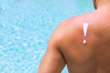 4 efeitos nocivos do sol na pele