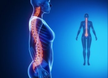 Artrose de coluna: diagnóstico e tratamento