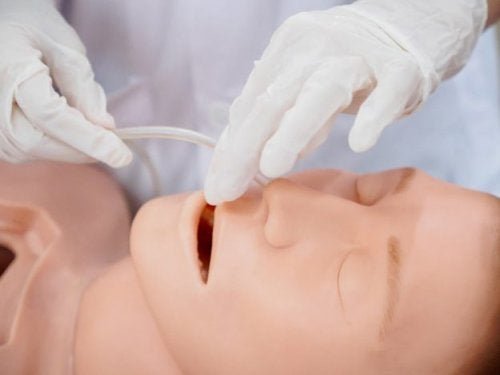 Manometria na acalasia