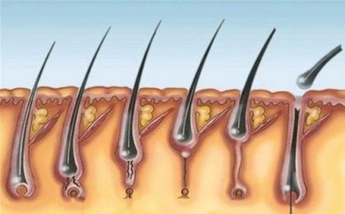 Pilomatricoma múltiplo: principais características