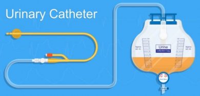 Tratamento da retenção urinária pós-parto