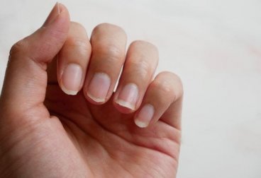 4 ingredientes naturais para tratar unhas quebradiças