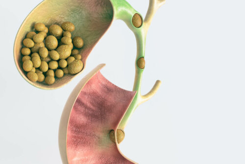 Vesícula obstruída