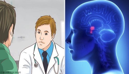 A consulta médica é fundamental para tratar o adenoma hipofisário
