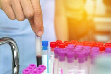Anemia em crianças: 7 sinais de alerta