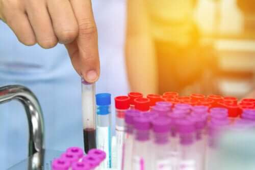 Anemia em crianças: 7 sinais de alerta