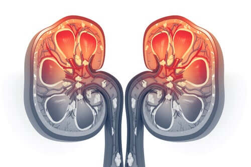 Fatores de risco para abscesso renal