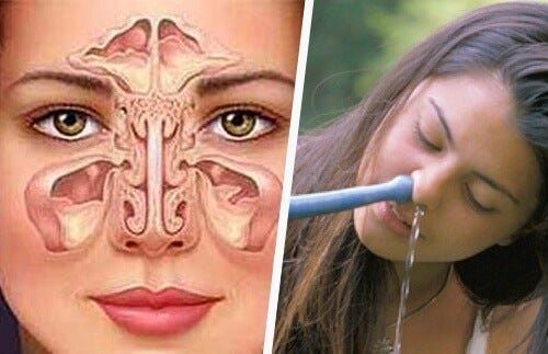 Mulher fazendo lavagem nasal