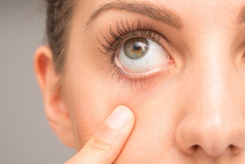 Aliviar os olhos irritados com soluções caseiras - Melhor com Saúde