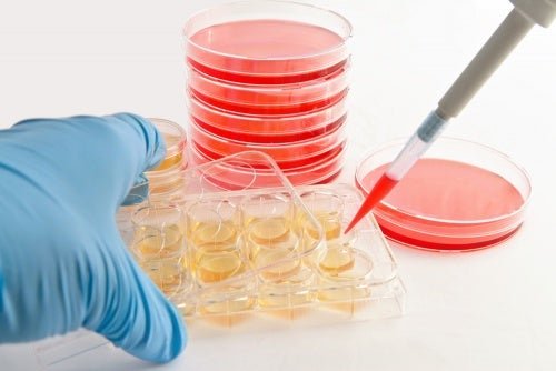 Cultivo para determinar a actinomicose