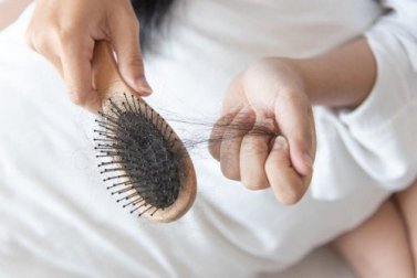 Reverter a queda de cabelo com 3 remédios caseiros