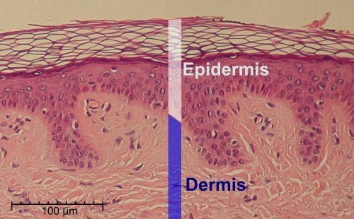 Os adesivos agem sobre a derme e epiderme