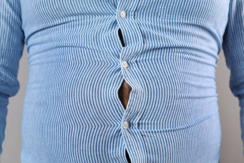 Obesidade