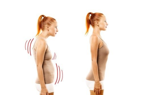 Manter uma postura correta melhora a saúde