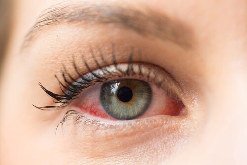 Mulher com olhos vermelhos.