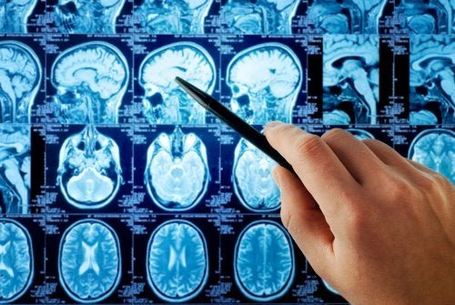 Ressonância magnética para diagnóstico