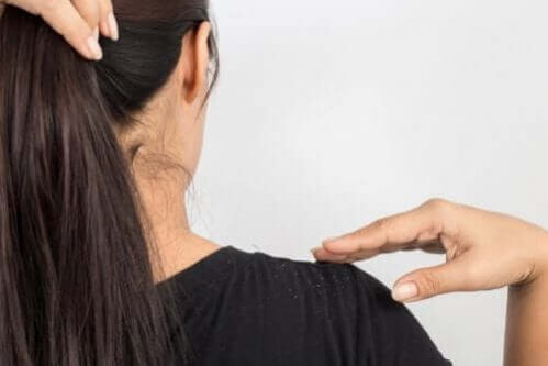 Tratamento com ovo para caspa no cabelo