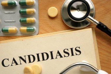 Candidíase genital: pode afetar minha vida sexual?