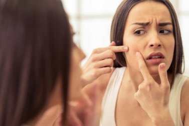 Cravos e espinhas: hábitos para evitar seu surgimento