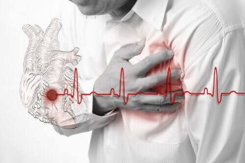 Principais causas do infarto do miocárdio