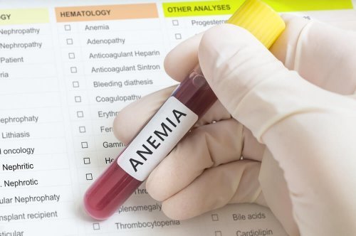 Exame de sangue para detectar anemia