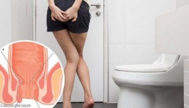 6 remédios caseiros e naturais para combater as hemorroidas