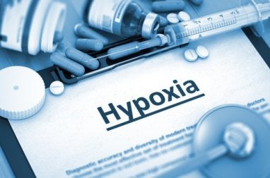 Hipóxia cerebral: tipos e causas