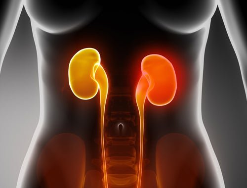 Insuficiência renal causa hiperfosfatemia